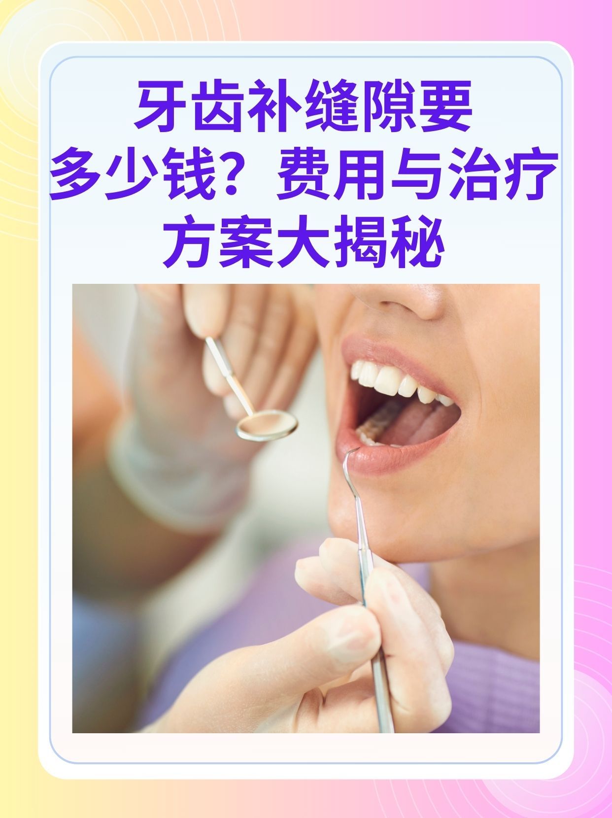 补牙医保可以报销吗(补牙医保可以报销吗 哪些可以报销呢)